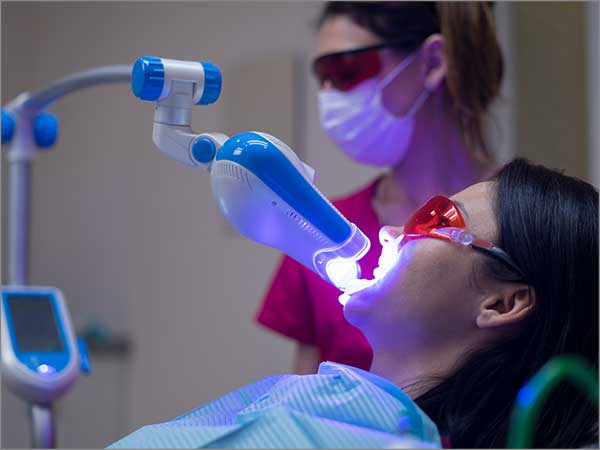 laser-teeth-whitening