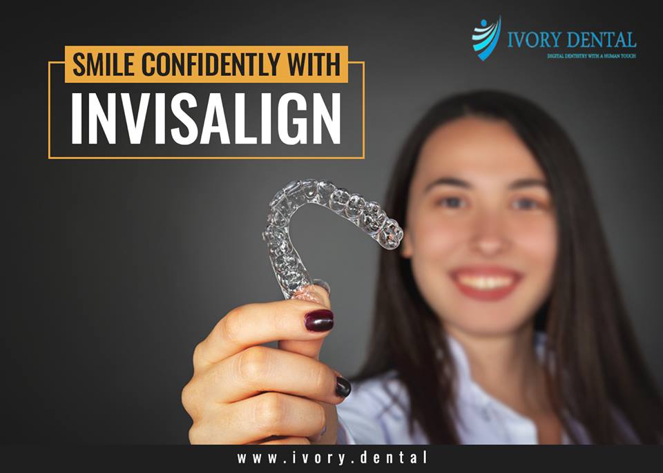 Invisalign Aligners In bangalore