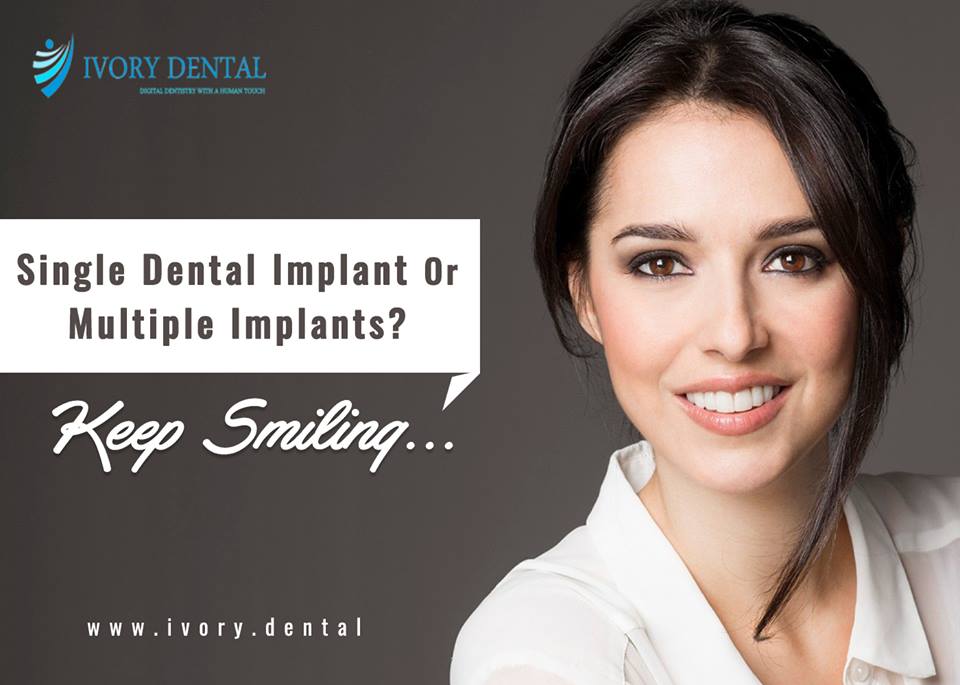 Multiple Dental Implant Bangalore