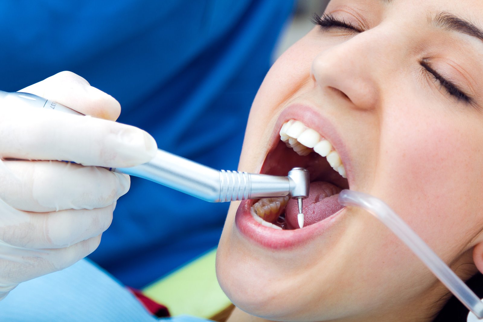 Root Canal Treatment for Saving Damaged Teeth